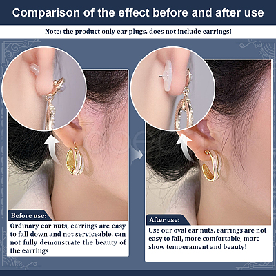36Pcs Acrylic Ear Nut for Women FIND-FG0004-77-1