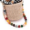 Bag Handles AJEW-BA00034-3